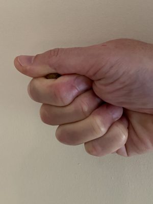 Treat Tightly Held for Gentle